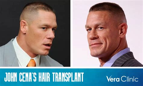 john cena wig collection|john cena bald spot.